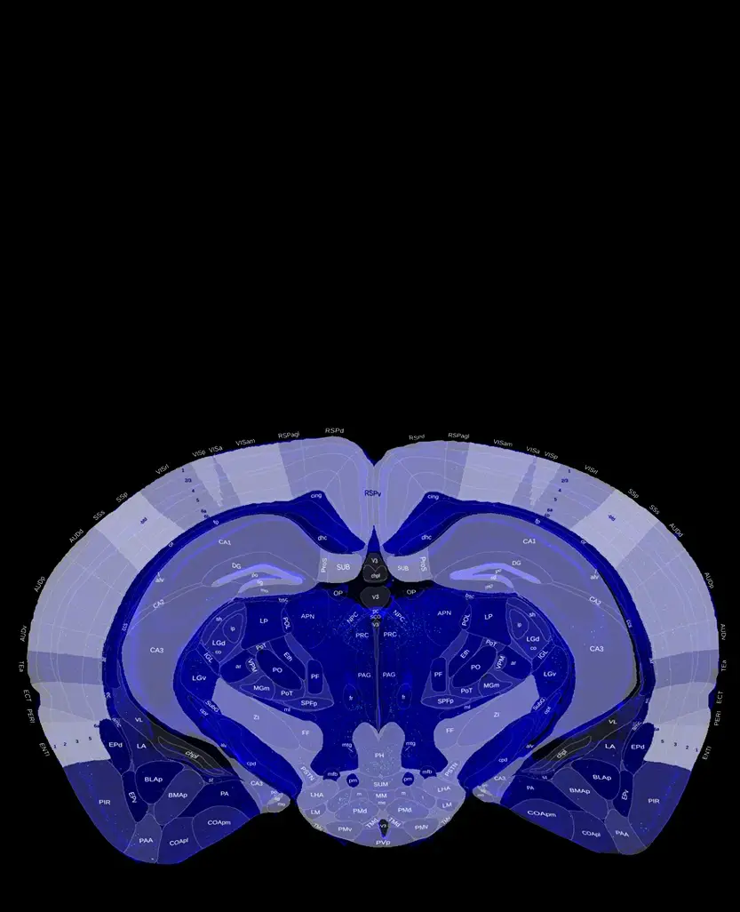 Automated Allen Brain Atlas registration with color-coded regions