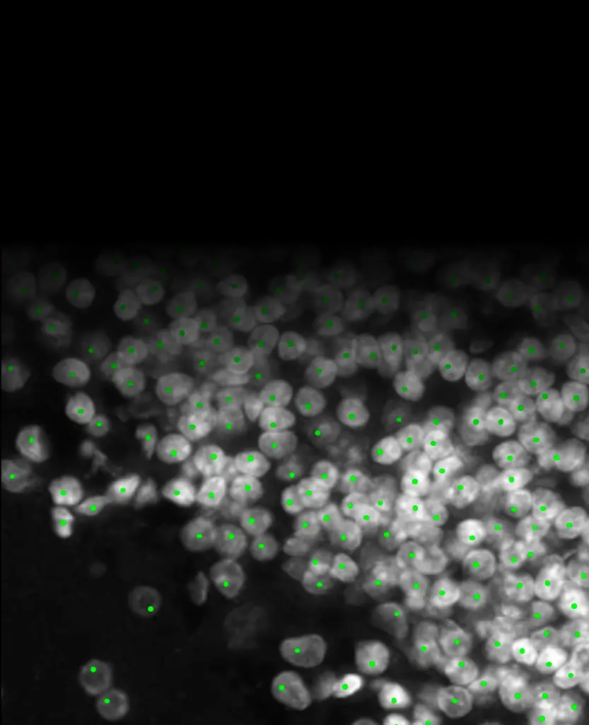 Automated cell detection with green markers on nuclei