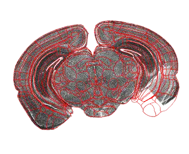 Atlas registration on damaged brain slice