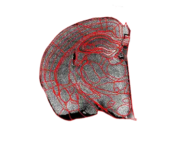 Atlas registration on severely damaged half brain slice