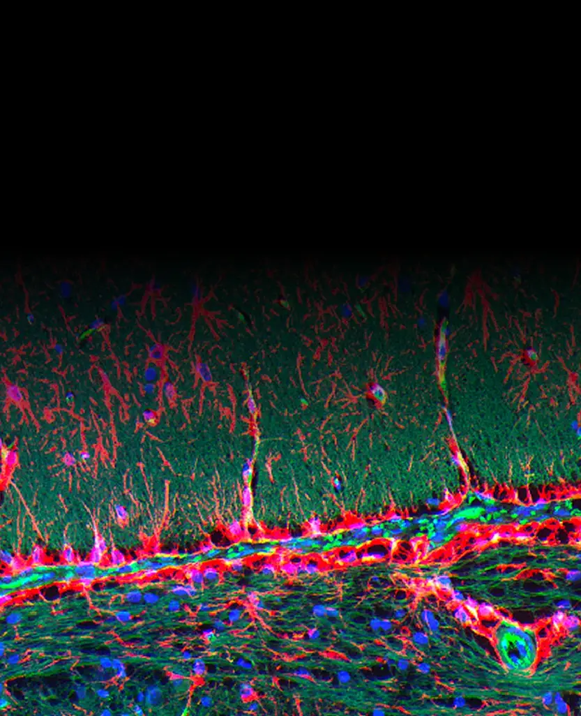 High-magnification multi-color neuron imaging