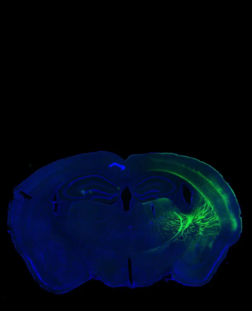 Dual-channel fluorescence brain scan showing DAPI and GFP expression