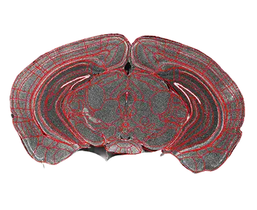 Atlas registration on tilted brain slice